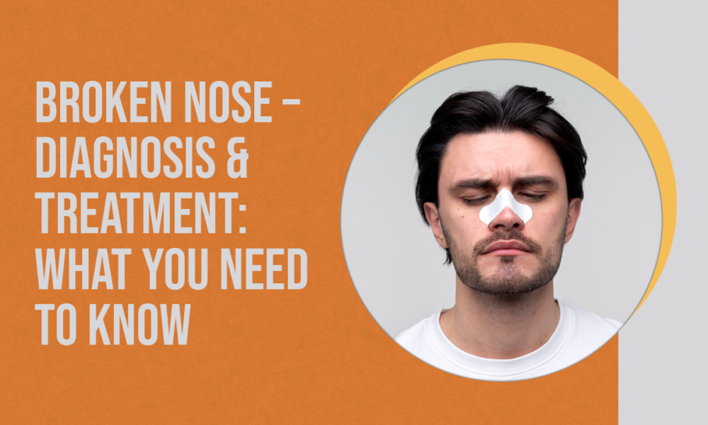Broken Nose Diagnosis