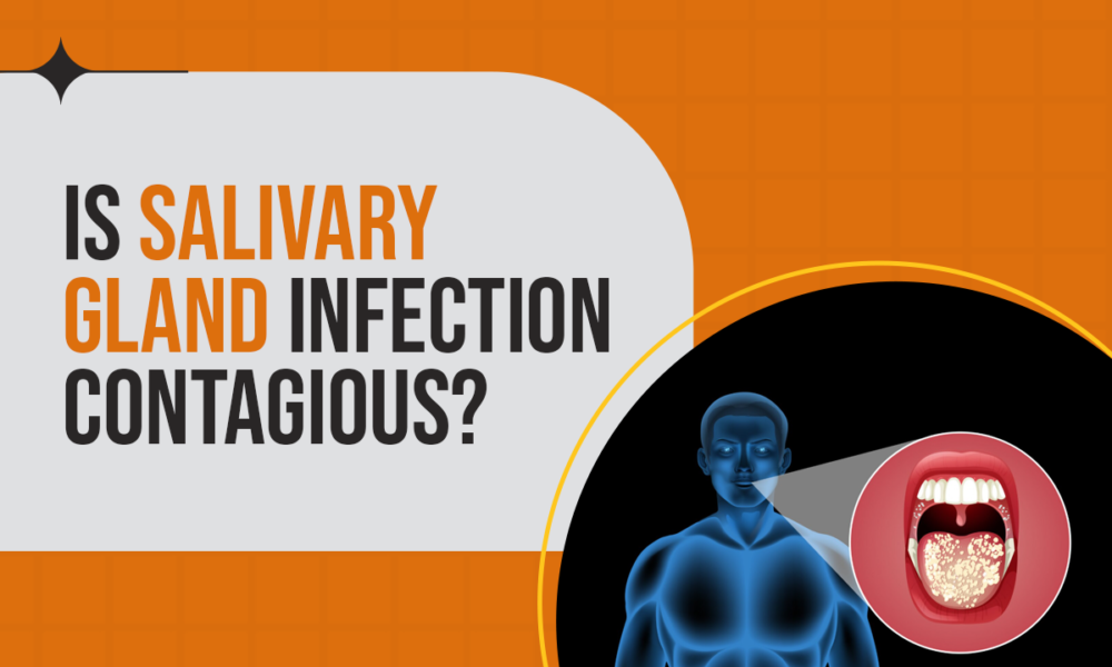 Salivaryglandinfection