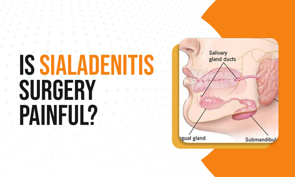 Sialadenitis