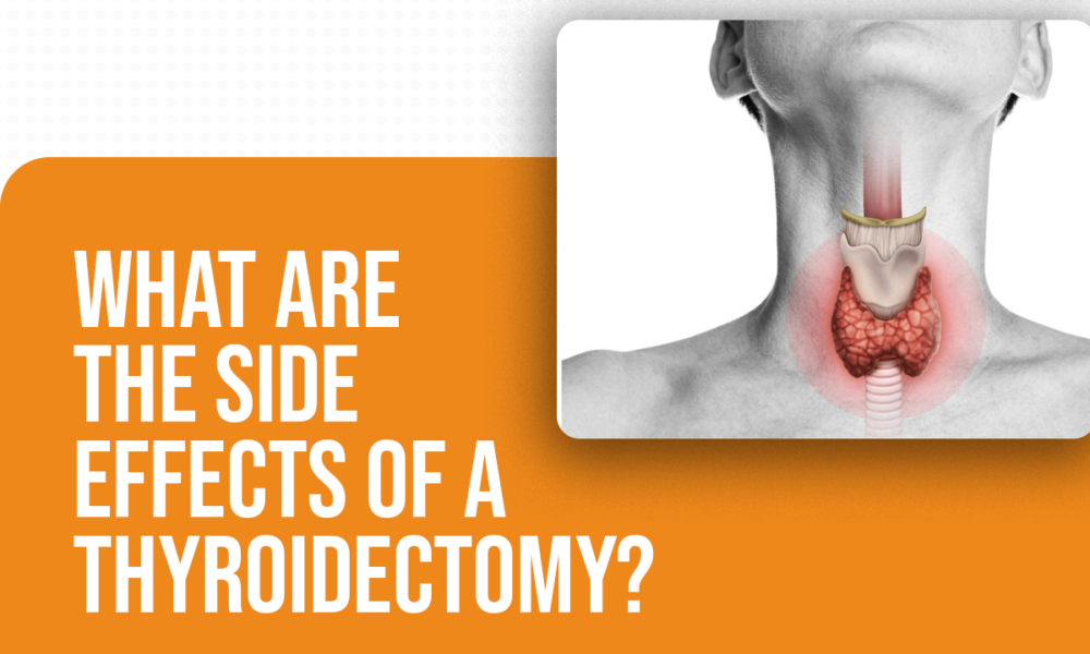 Thyroidectomy