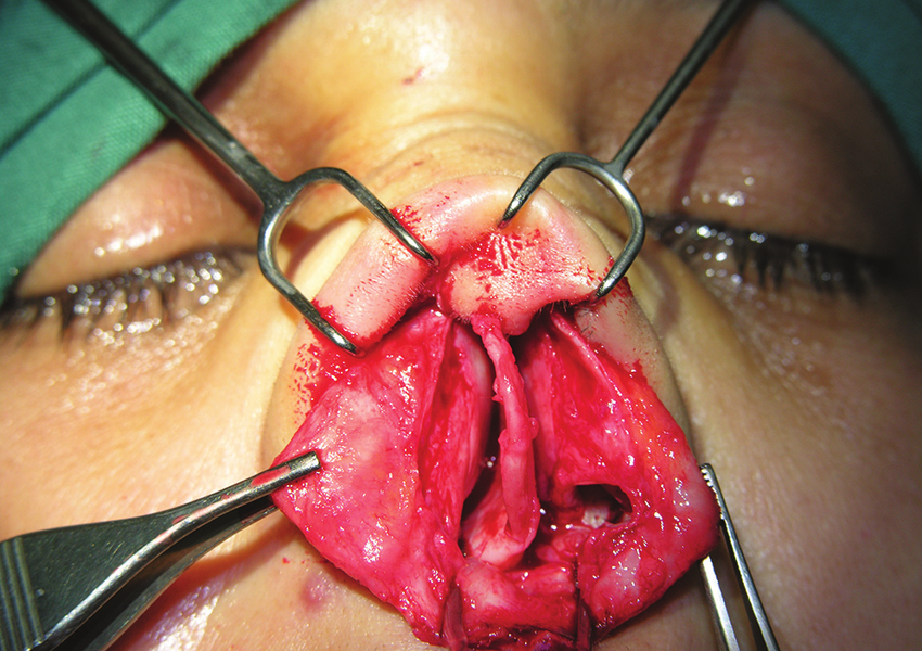 Sinus Treatment specialist In nashik