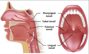 Diagram showing tonsil anatomy, including the pharyngeal, tubal, palatine, and lingual tonsils