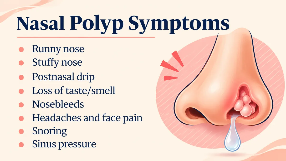 Nasal polyp symptoms: runny nose, stuffy nose, postnasal drip, loss of taste or smell, nosebleeds, headaches and face pain, snoring and sinus pressure